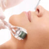 Curso de Microagulhamento (Dermaroller e Dermapen)