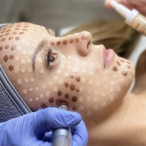 Curso de BB Glow (Pele de Porcelana) + Mascara de Led