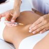 Curso de Mesoterapia ( Enzimas Lipolíticas)